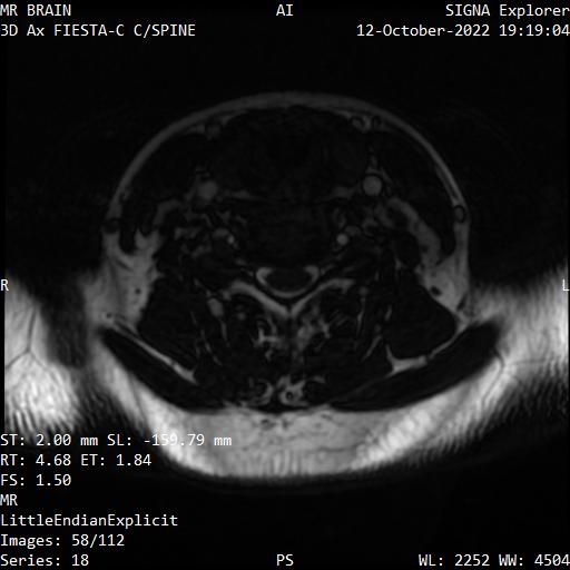 Series 018 image 58