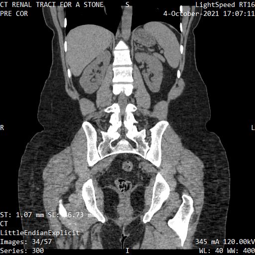 Series 300 image 34