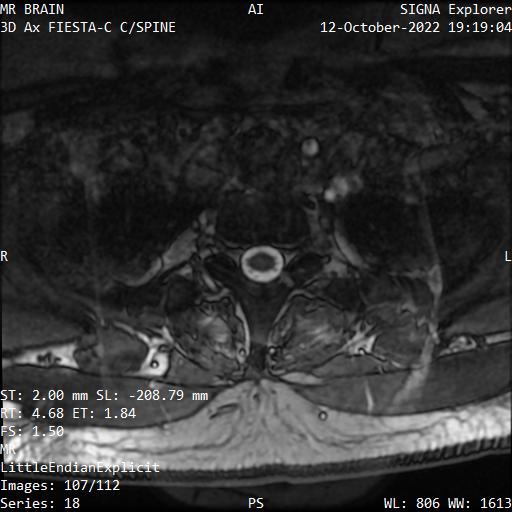 Series 018 image 107