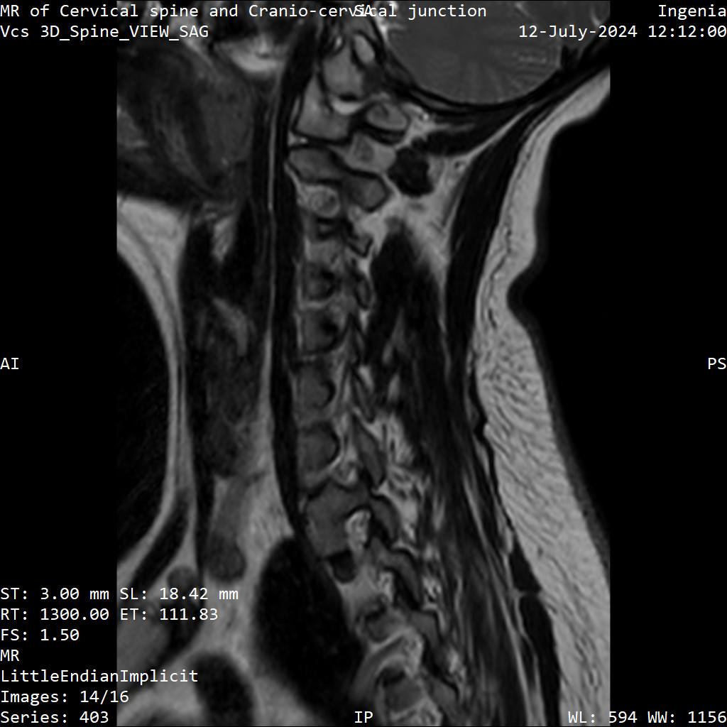Series 403 image 14