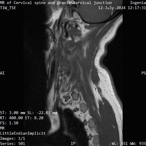 Series 501 image 1