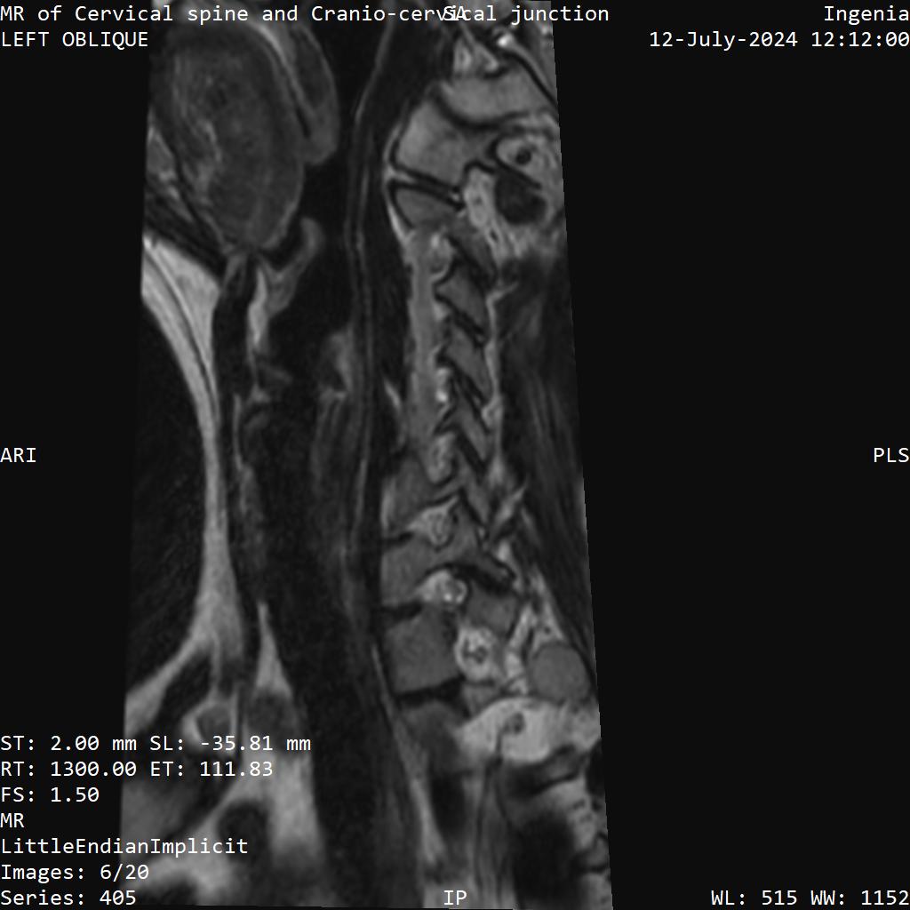Series 405 image 6
