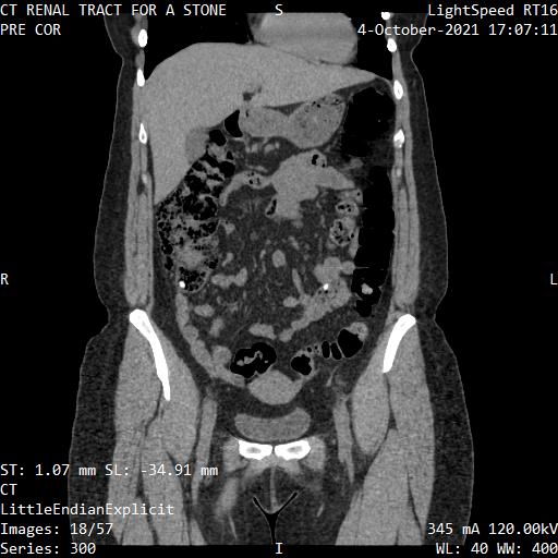 Series 300 image 18