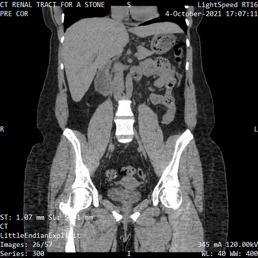 Series 300 image 26