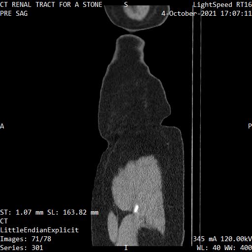 Series 301 image 71