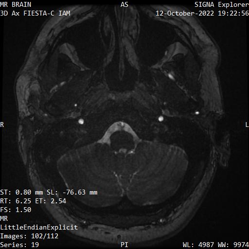 Series 019 image 102