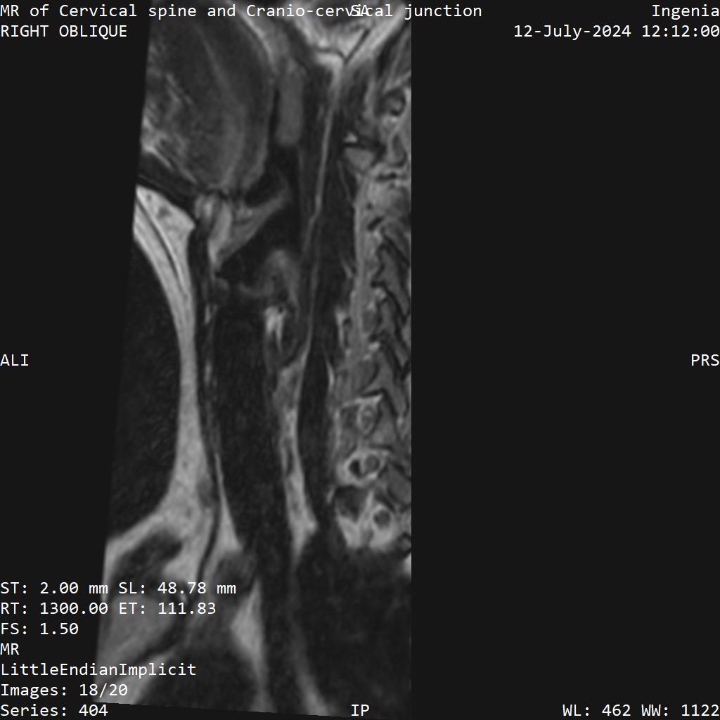 Series 404 image 18