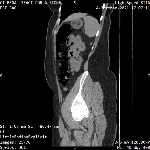 Series 301 image 25