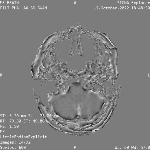 Series 600 image 14