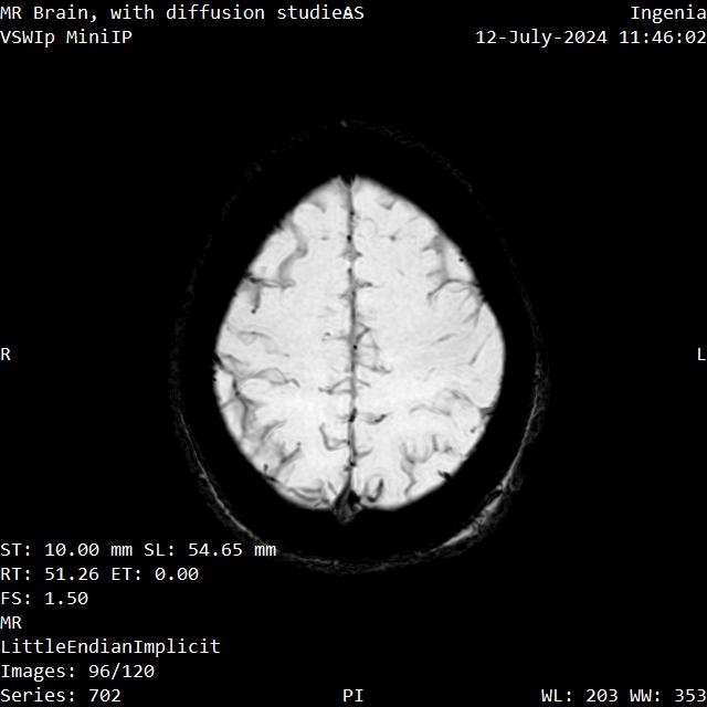 Series 702 image 96