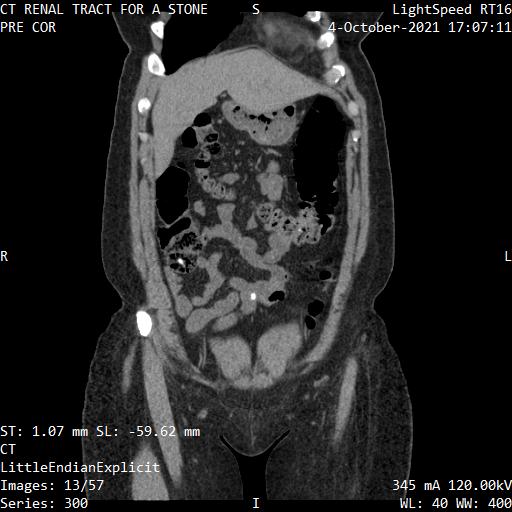 Series 300 image 13