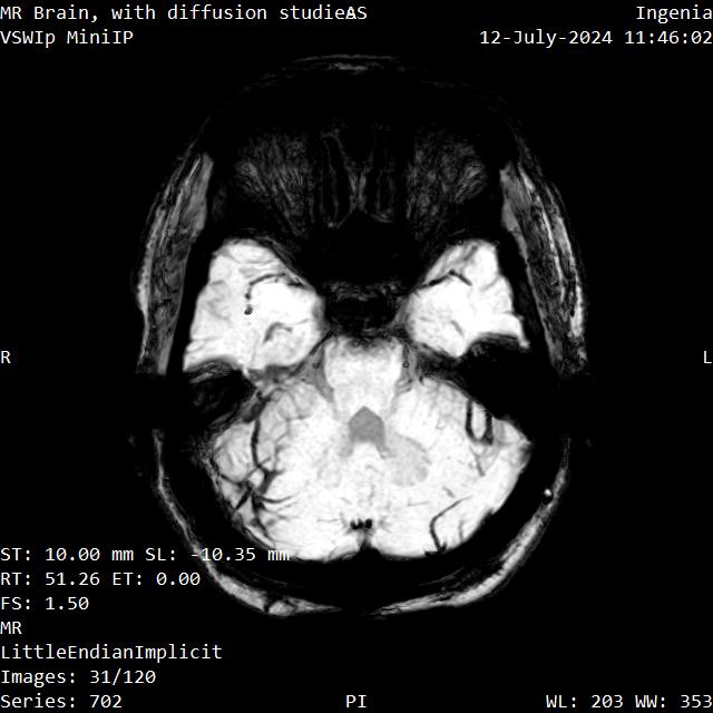 Series 702 image 31