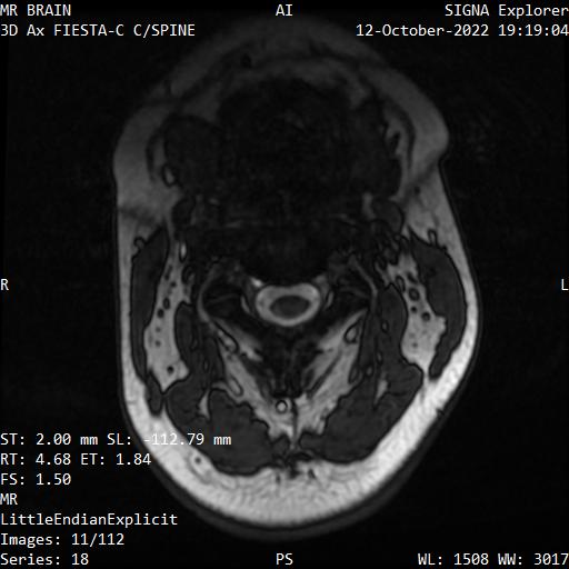 Series 018 image 11