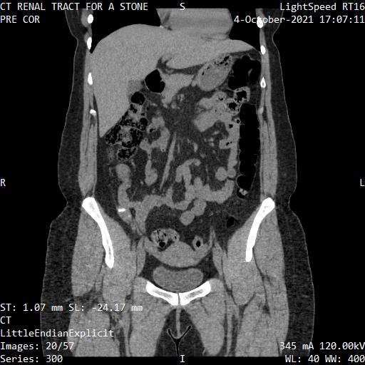 Series 300 image 20