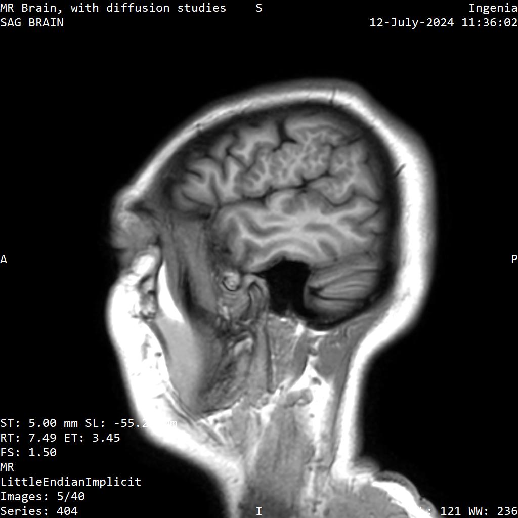 Series 404 image 5