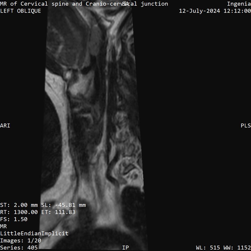 Series 405 image 1