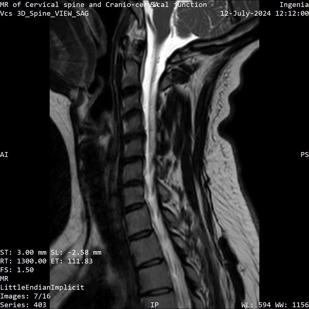 Series 403 image 7