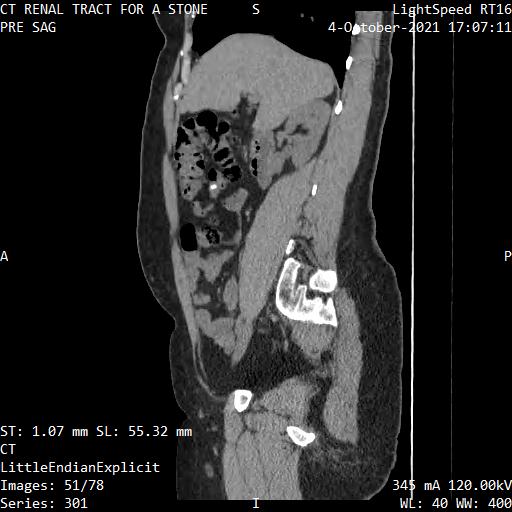 Series 301 image 51