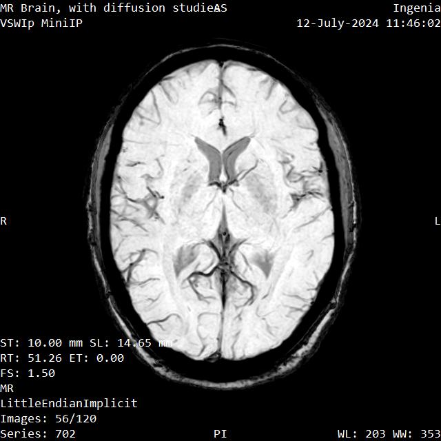 Series 702 image 56