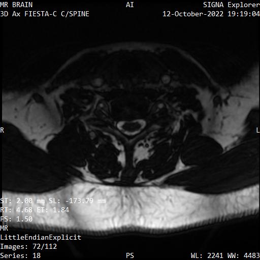 Series 018 image 72