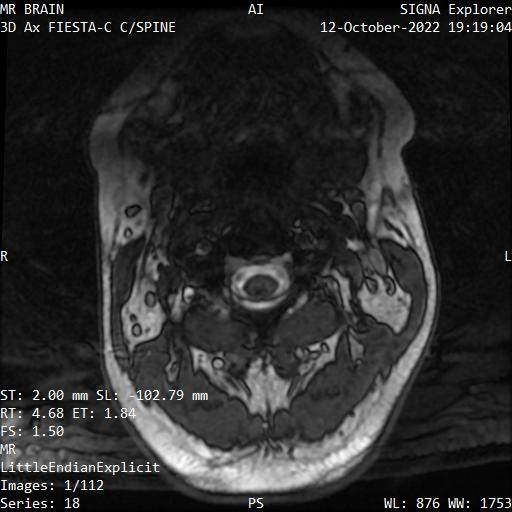 Series 018 image 1