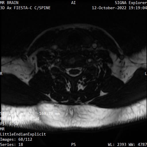 Series 018 image 68