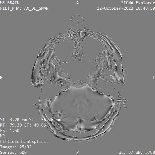 Series 600 image 25