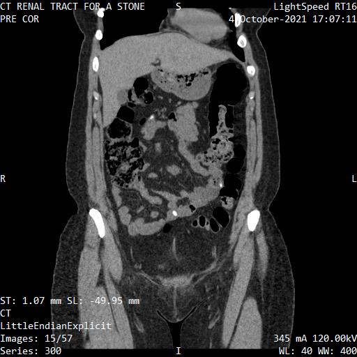 Series 300 image 15