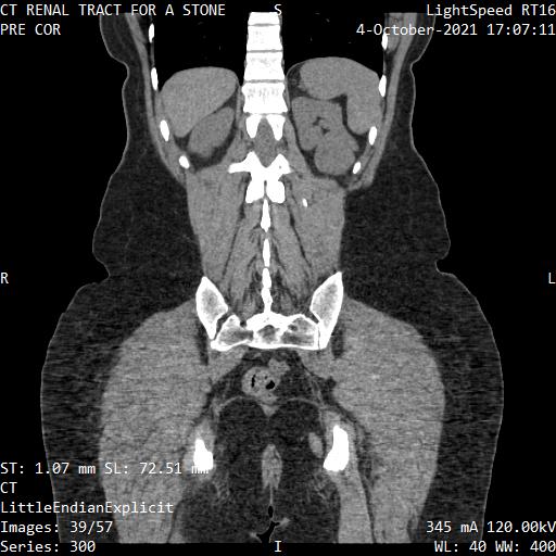 Series 300 image 39