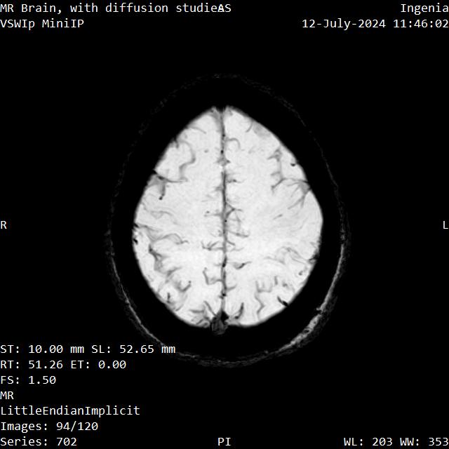 Series 702 image 94
