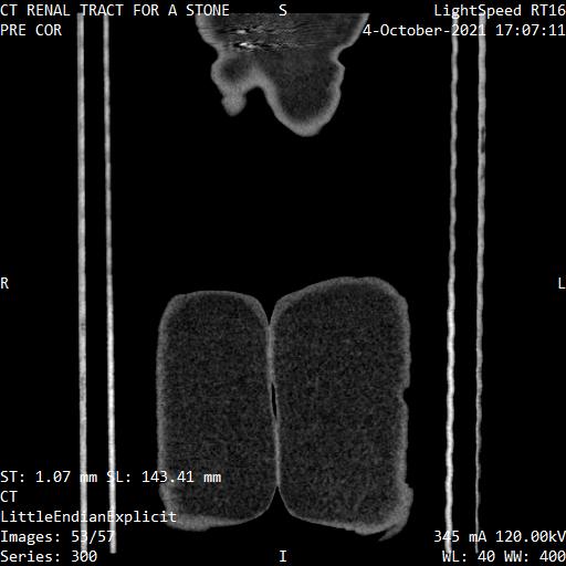 Series 300 image 53