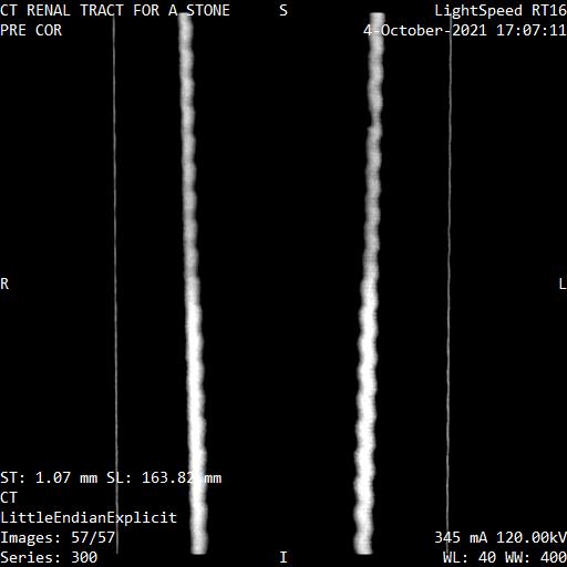 Series 300 image 57