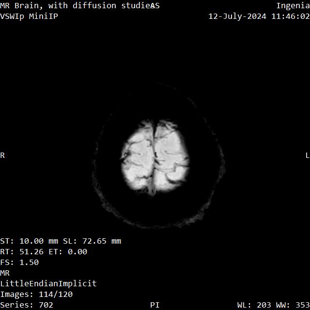 Series 702 image 114