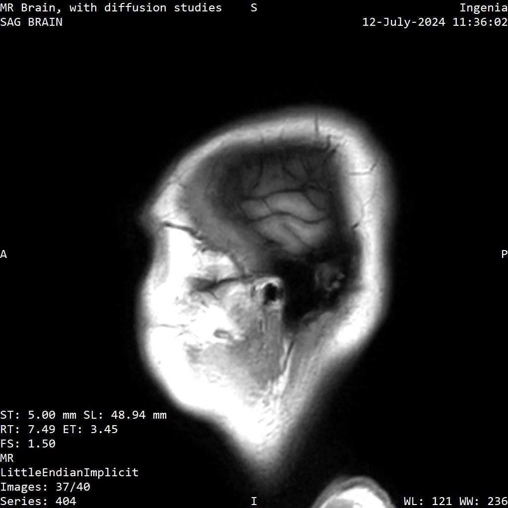 Series 404 image 37