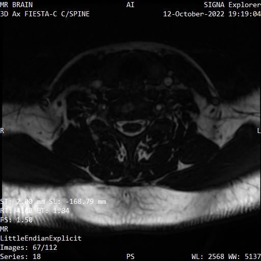 Series 018 image 67