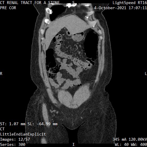 Series 300 image 12