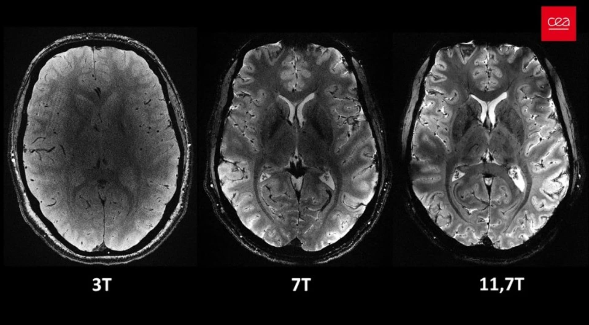 Comparison of brain MRI images obtained using different magnetic field strengths, including 3T, 7T and 11.7T