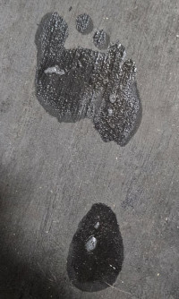 High arches (pes cavus)